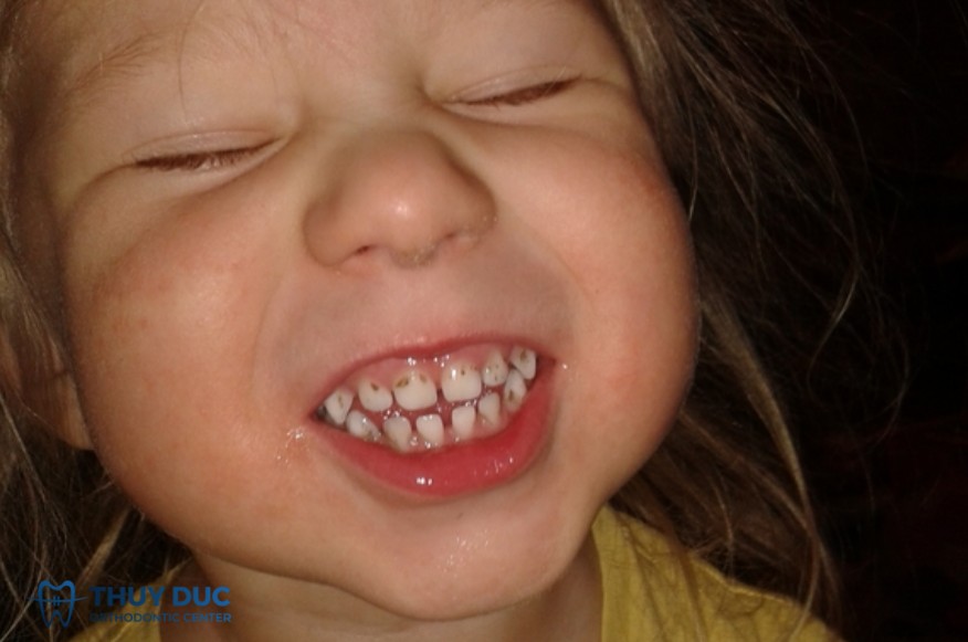 3. Ảnh hưởng của thuốc chứa sắt 1 3. Ảnh hưởng của thuốc chứa sắt 1