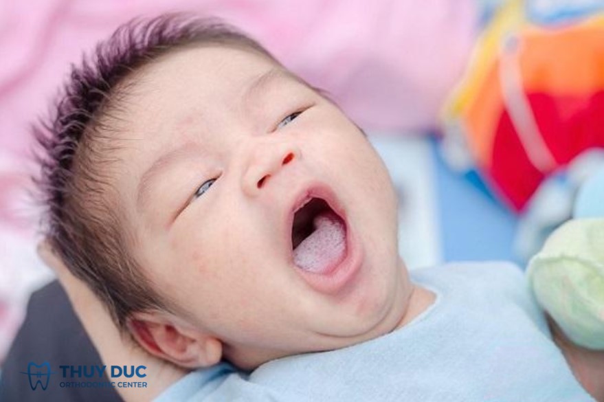 5. Lưỡi trắng, lưỡi rêu dày 1 5. Lưỡi trắng, lưỡi rêu dày 1