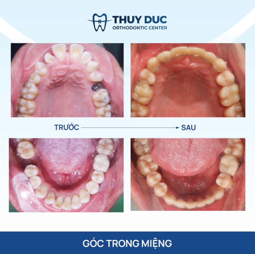 3. Câu hỏi thường gặp 1 3. Câu hỏi thường gặp 1