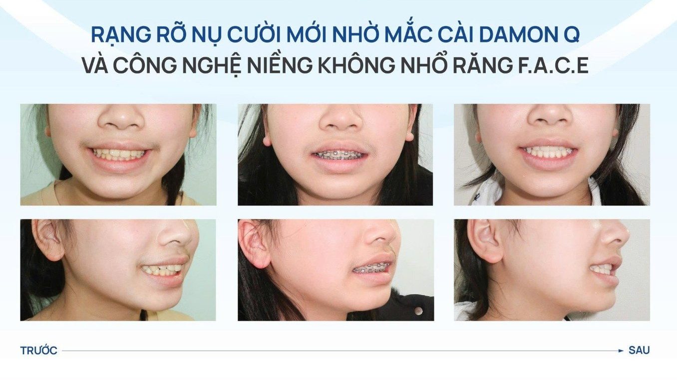 5. Cam kết hiệu quả thẩm mỹ và sức khỏe lâu dài 1