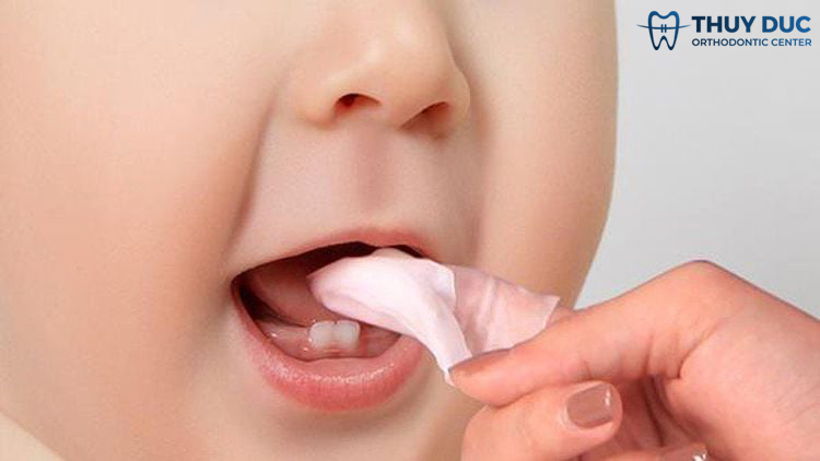 1. Lau nướu và răng bằng gạc sạch 1 1. Lau nướu và răng bằng gạc sạch 1