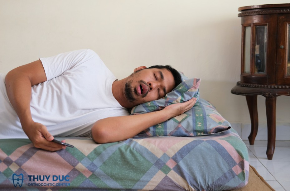 Nguyên nhân gây khớp cắn sâu 1 Nguyên nhân gây khớp cắn sâu 1