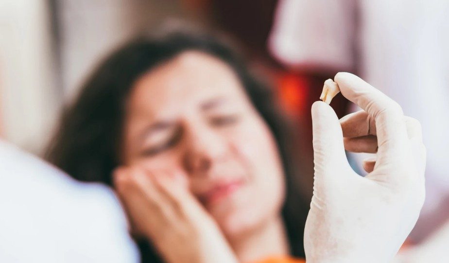 1. Nhổ răng hoặc tiểu phẫu trước niềng 1