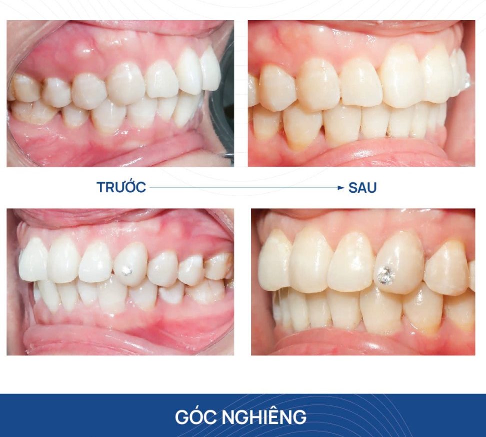 Một số quan niệm phổ biến 1