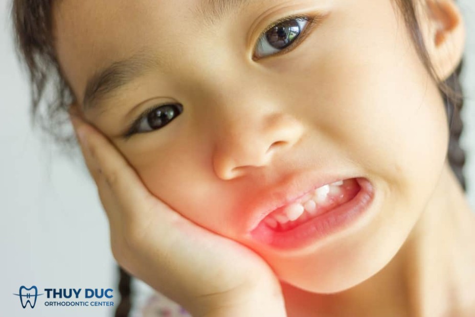 Các triệu chứng rõ ràng 1 Các triệu chứng rõ ràng 1