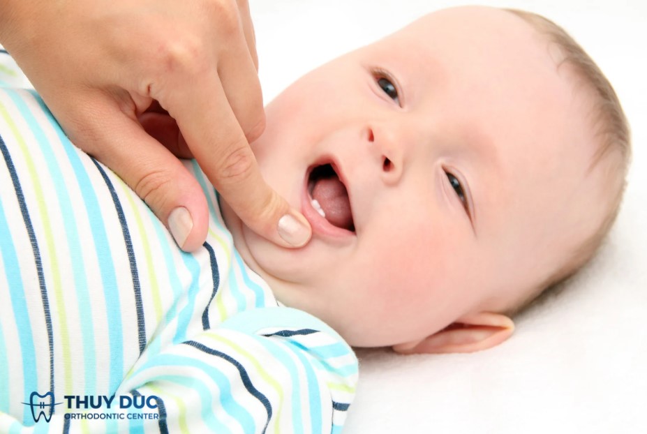 2. Sự khác biệt giữa mọc răng chậm và thiếu răng bẩm sinh 1 2. Sự khác biệt giữa mọc răng chậm và thiếu răng bẩm sinh 1